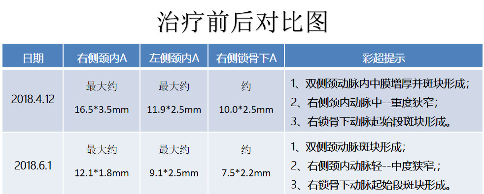 HOT治療對動脈粥樣硬化斑塊的影響4.jpg